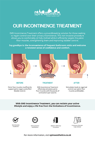 image of how urge incontinence Hockley treatment works
